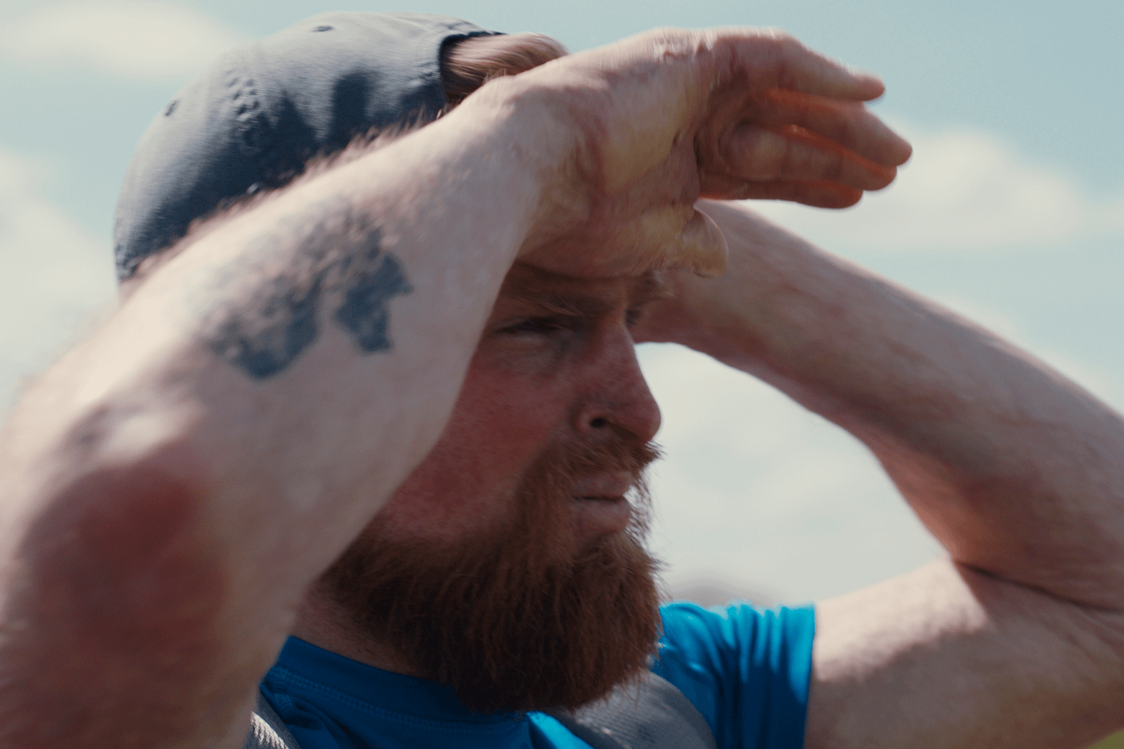 A bearded white man wearing a cap turned backwards is seen holding his arms up and looking towards the right side of the photo. He has a black tattoo on his arm below the elbow and his hand appears scarred and rested on his forehead